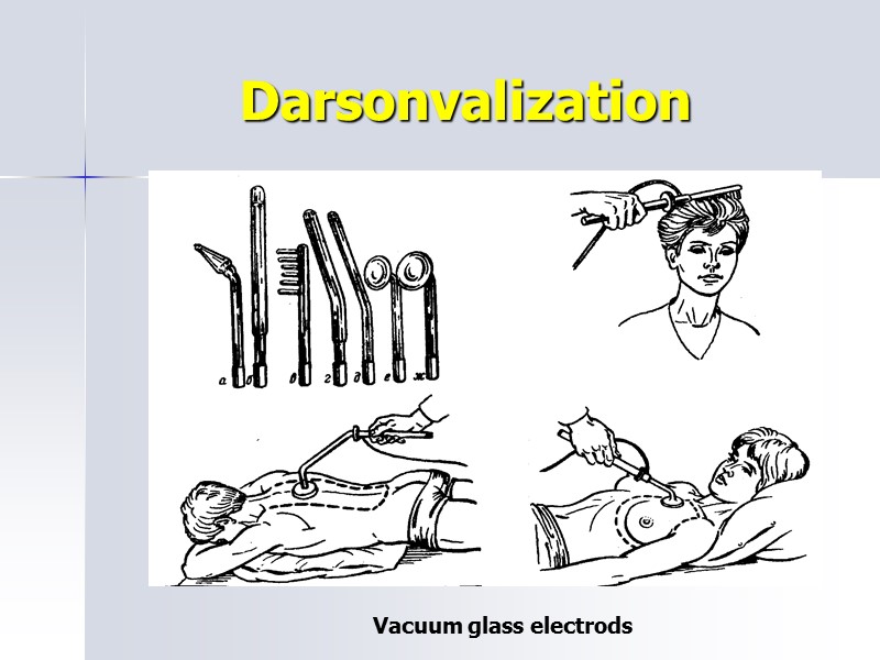 Darsonvalization Vacuum glass electrods